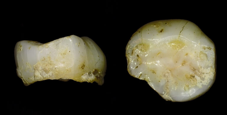 © BONES Lab - Università di Bologna/Soprintendenza archeologia, belle arti e paesaggio del Friuli Venezia-Giulia dente da latte del cacciatore